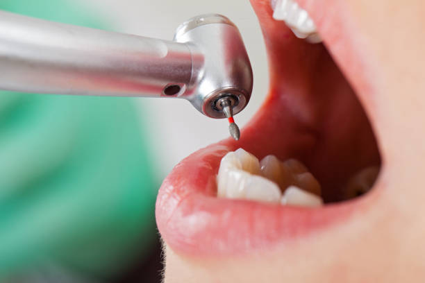 Best Emergency Dentist for Knocked-Out Tooth in Algona, IA